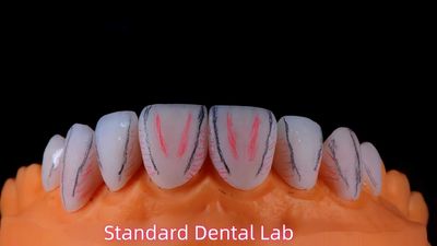 Standard Dental Lab Co., Limited ligne de production du fabricant