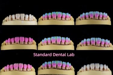 Standard Dental Lab Co., Limited ligne de production du fabricant