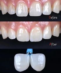 Standard Dental Lab Co., Limited ligne de production du fabricant