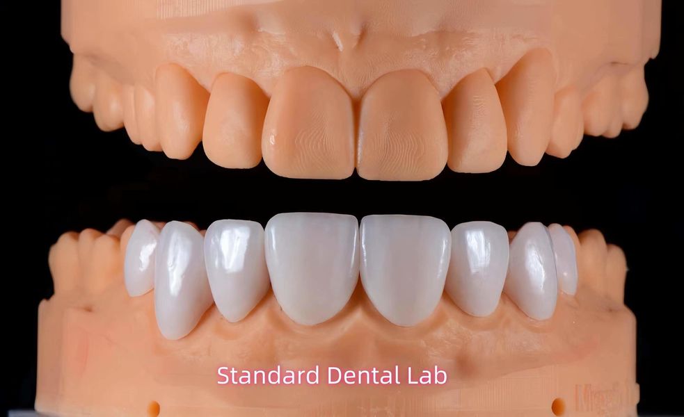 Standard Dental Lab Co., Limited ligne de production du fabricant