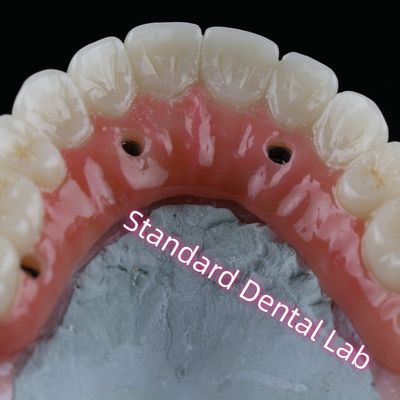 acheter Croix d'implant dentaire PFZ Porcelaine à vis en zirconium recouverte de gomme rose fabrication en ligne