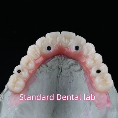 acheter Porcelaine Zirconia pont implant dentaire professionnel haute esthétique avec gomme rose fabrication en ligne