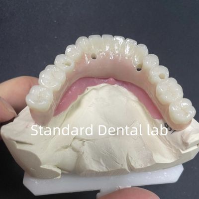 acheter Restauration esthétique Tout sur 4 implants dentaires Zirconia Hypoallergénique fabrication en ligne