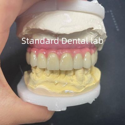 acheter Le pont Malo Hybride Zirconia Tout sur quatre / six Zirconia Implant Bridge Bar Titanium fabrication en ligne