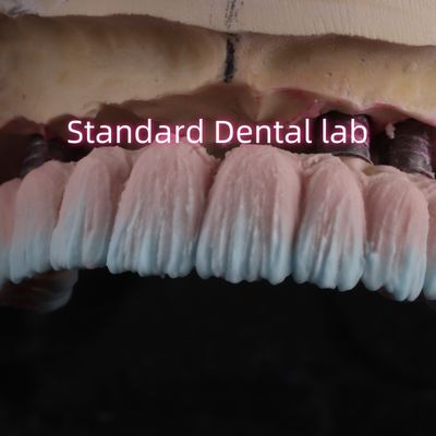 acheter Vis de pont d'implant en zirconium retenu avec de la porcelaine rose fabrication en ligne