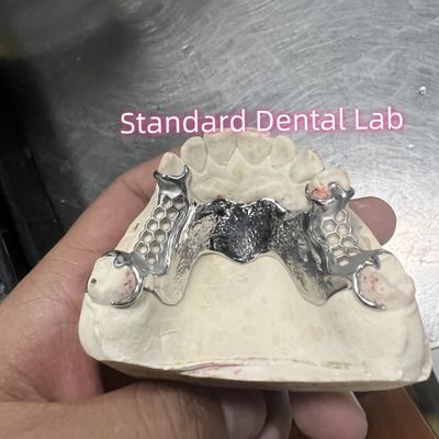 acheter Cortex coulé en cobalt chrome denture partielle Vitallium 2000 fabrication en ligne