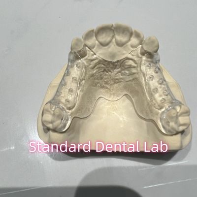 acheter Cadre transparent en fonte amovible partiel facile à nettoyer et à enlever fabrication en ligne