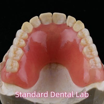 acheter Prothèse dentaire temporaire en acrylique Ivoclar fabrication en ligne