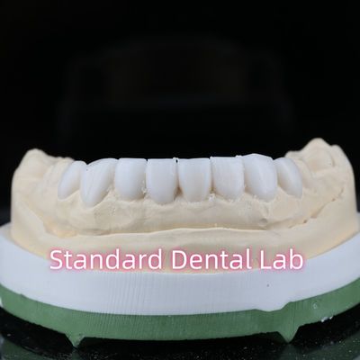 acheter Diagnostique Dentisterie restauratrice Vase vers le haut Veneurs haute esthétique fabrication en ligne