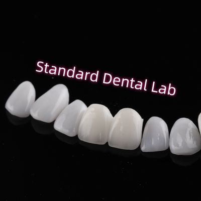 acheter Résistant à l'abrasion Emax Zirconia placage stratifié Translucide incisive fabrication en ligne