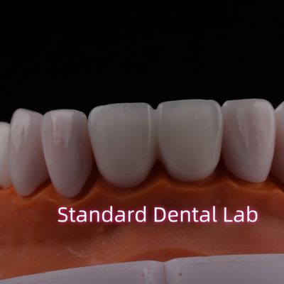 acheter Translucides Émax Zirconia placage laminé Porcelaine placage dentaire Verystable chimiquement fabrication en ligne