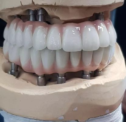 acheter Ciment à vis en zirconium fabriqué avec précision pour les implants de dents d'aspect naturel fabrication en ligne