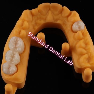 acheter Des dents esthétiques en céramique et en porcelaine fabrication en ligne