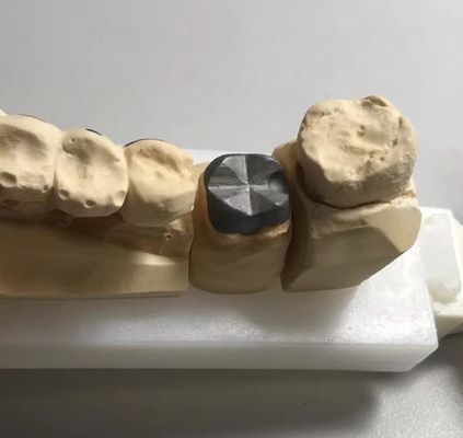 acheter ISO FDA CE Points métalliques dentaires et couronne de noyau fabrication en ligne