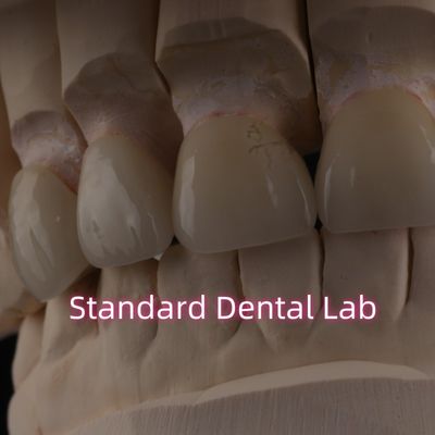 acheter Laboratoire dentaire professionnel couronne de zirconium pour la restauration fixe fabrication en ligne