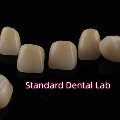 acheter Dentistique Couronnes en zirconium à couches fortes Restauration complète de l'arche supérieure fabrication en ligne