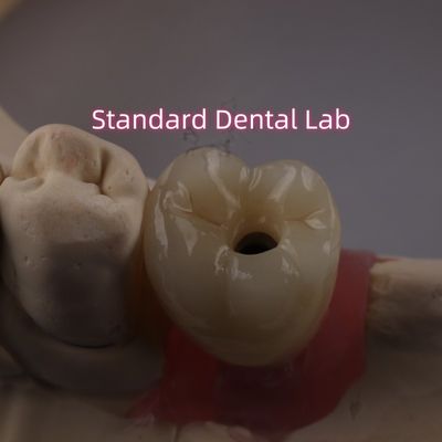 acheter Croix d'implant dentaire à vis PFZ en porcelaine en zirconium en couche fabrication en ligne