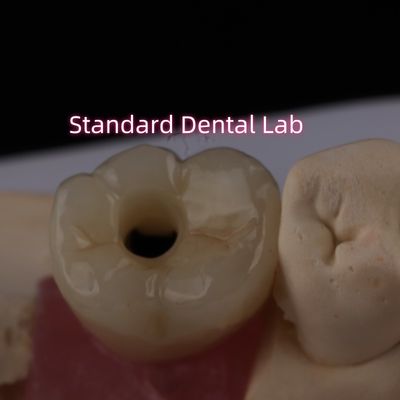 acheter Implantation postérieure couronne bruxier vis en zirconium solide retenue fabrication en ligne