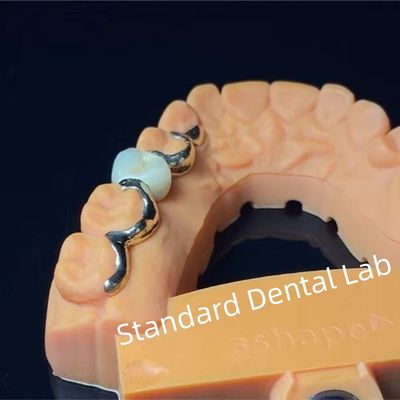 acheter Dentistique PFM Maryland Bridge haute esthétique certifiée FDA fabrication en ligne