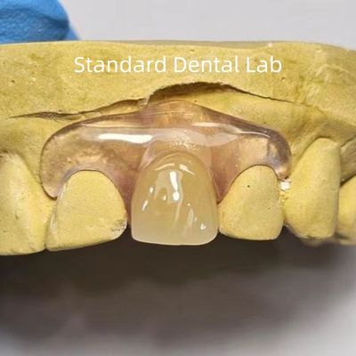 acheter TCS dentaire Valplast Flexible Prothèses partielles de teinture résistant aux odeurs décolorantes fabrication en ligne