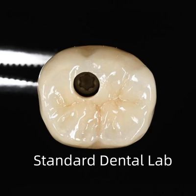 acheter Couronne d'implant dentaire à vis fabrication en ligne