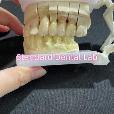 acheter Métal coulé non précieux CoCr Porcelain Bridge Dental CCM fabrication en ligne