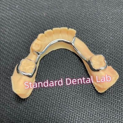 acheter Maintien de l' espace bilatéral dentaire pour les dents manquantes fabrication en ligne