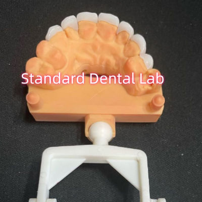 acheter Laminé d'aspect naturel Zirconia Emax Faisceaux épaisseur 0,6 mm fabrication en ligne