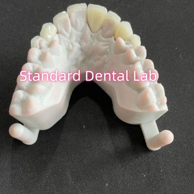 acheter Les dents dentaires du sourire des étoiles Emax Zirconia Veneurs stratifiés 0,6 mm fabrication en ligne
