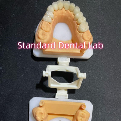 acheter Dentistique Restaurative Dentisterie Soins bucco-dentaires Couronne complète en zirconium personnalisée fabrication en ligne