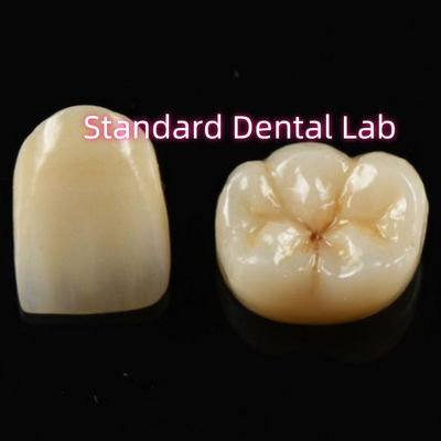 acheter Matériau biocompatible esthétique couronne de zircone de zircone dents de pont fabrication en ligne