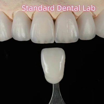 acheter Pont dentaire en zirconium à haute esthétique naturel sur mesure fabrication en ligne