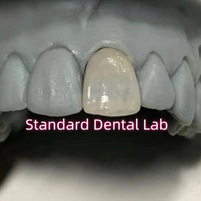 acheter Dentisterie restauratrice couronnes en porcelaine en zirconium fabrication en ligne