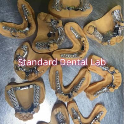 acheter Dentures partielles de cadre en métal moulé en cobalt chrome amovible fabrication en ligne
