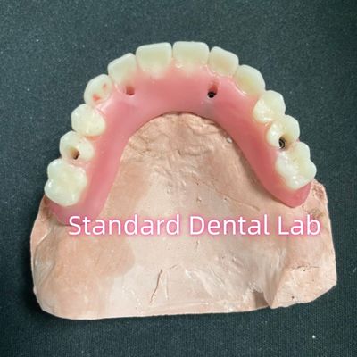 acheter Implantation partielle en acrylique sur denture en titanium Bar denture complète fabrication en ligne