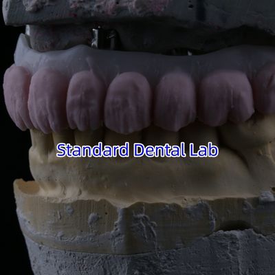 acheter Porcelaine tout sur quatre Pont de zirconium Haut esthétique Pont d'implant dentaire fabrication en ligne