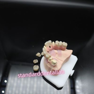 acheter Pont d'implantation dentaire numérique en titane Ivoclar Hybride Zirconia fabrication en ligne