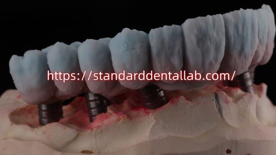 acheter Pont en zirconium à support d'implant avec apotement en titane fabrication en ligne