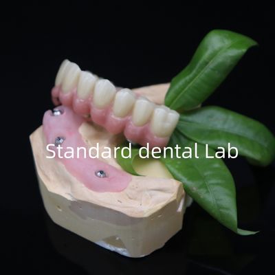 acheter Enroué tout sur 6 plein Zirconia pont dentaire haute précision sur base Ti fabrication en ligne