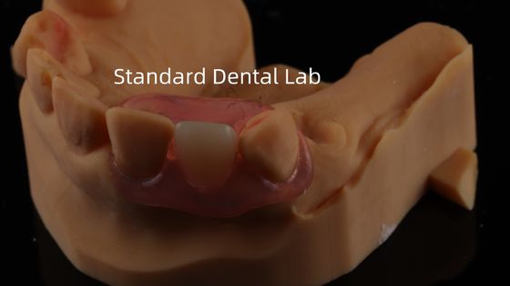 acheter Dentiste TCS Valplast Dentures partielles flexibles Nesbit Valplast Finition Chine Laboratoire dentaire Valplast Fermeture fabrication en ligne