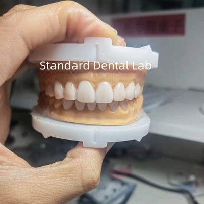 acheter Une esthétique parfaite pour les dentistes utilisant de la cire dentaire du laboratoire dentaire chinois fabrication en ligne