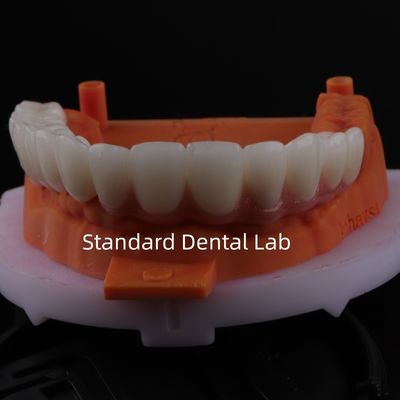 acheter Bien ajusté, esthétique, précis, zirconium, porcelaine, couronne, porcelaine rose, avec teinte de blanchiment fabrication en ligne