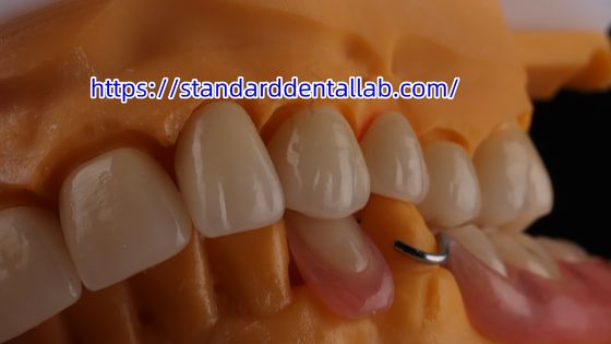 acheter Couronne dentaire en zircone et pont translucide 3D PRO couronne en porcelaine en zircone fabrication en ligne
