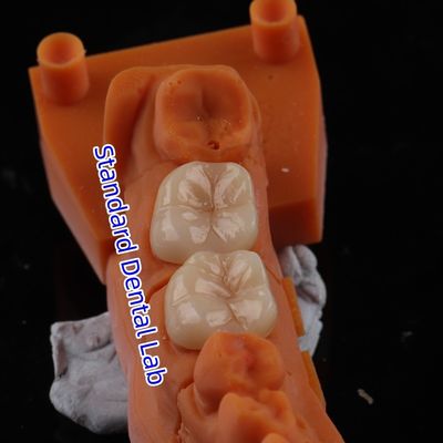 acheter La couronne en zirconium translucide 3D PRO sans revêtement en porcelaine fabrication en ligne