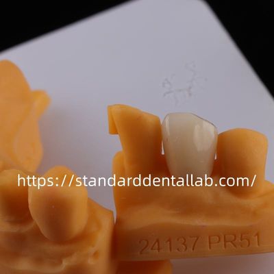 acheter Laboratoire dentaire à contour complet couronnes à haute translucideur couronne solide en zirconium laboratoire dentaire chinois fabrication en ligne