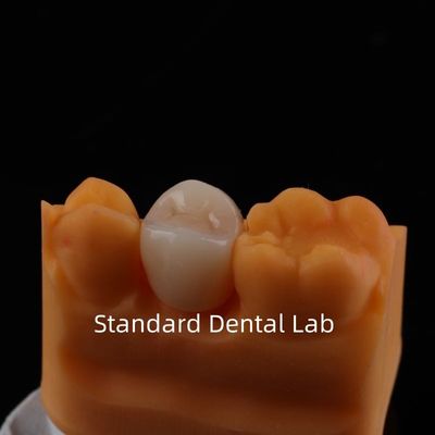 acheter Couronne en zirconium à contour complet Forteur et esthétique exceptionnelles Pas de revêtement en porcelaine Couronne postérieure Laboratoire dentaire chinois fabrication en ligne
