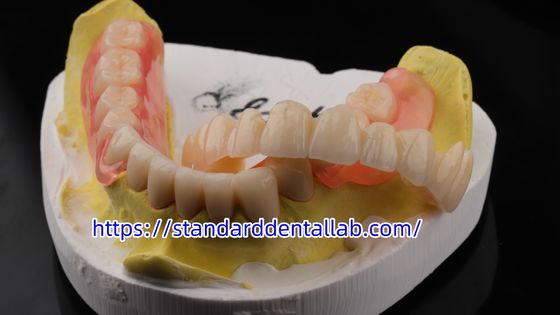 acheter L'esthétique est élevée TCS Valplast Dentistique Flexible Prothèses Dentaires Partielles Lab Valplast Fermeture Rose fabrication en ligne