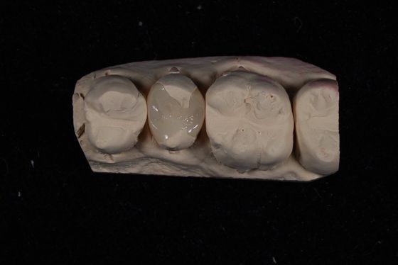 acheter Résistance couronne de placage en céramique Emax avec une excellente résistance aux taches / biocompatibilité fabrication en ligne