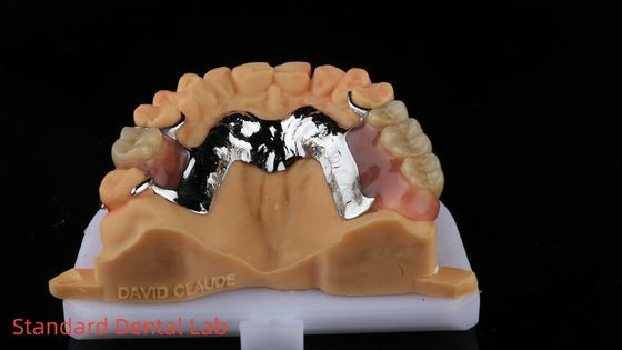 acheter CorCr Métal Prothèse partielle Haut léger Béryllium libre Ivoclar Scheftner Confortable cadre métallique fabrication en ligne