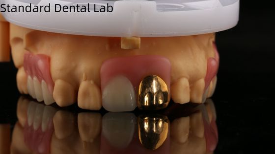 acheter Prothèses dentaires entièrement en acrylique avec dents en or jaune/Prothèses dentaires temporaires en acrylique Ivoclar Professionnel approuvées par la FDA fabrication en ligne